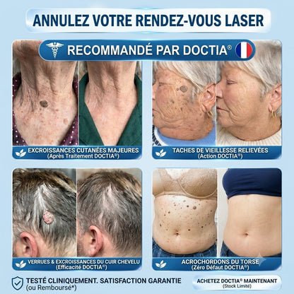 DOCTIA® Stylo Roller Haut de Gamme🍓