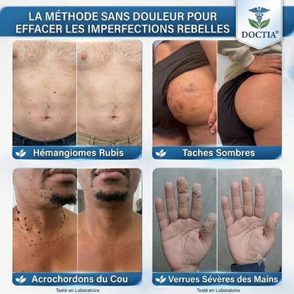 DOCTIA® Stylo Roller Haut de Gamme🍓