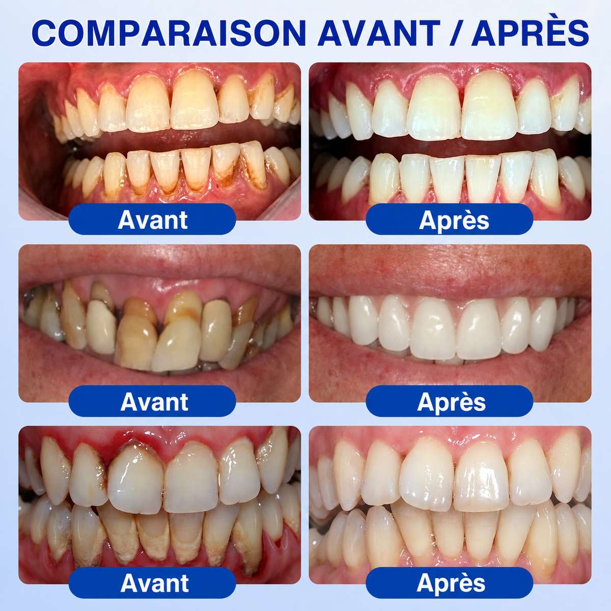 🏅🦷🛡️DOCTIA® GumRevive – Gel Réparateur Parodontal pour Gencives Sensibles🍃🍃
