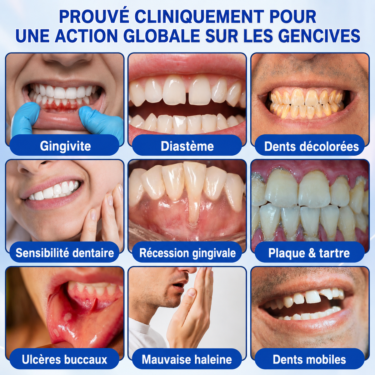 🏅🦷🛡️DOCTIA® GumRevive – Gel Réparateur Parodontal pour Gencives Sensibles🍃🍃