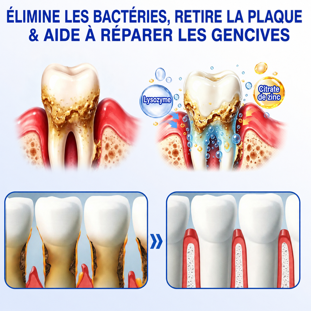 🏅🦷🛡️DOCTIA® GumRevive – Gel Réparateur Parodontal pour Gencives Sensibles🍃🍃