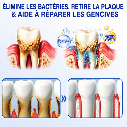 🏅🦷🛡️DOCTIA® GumRevive – Gel Réparateur Parodontal pour Gencives Sensibles🍃🍃