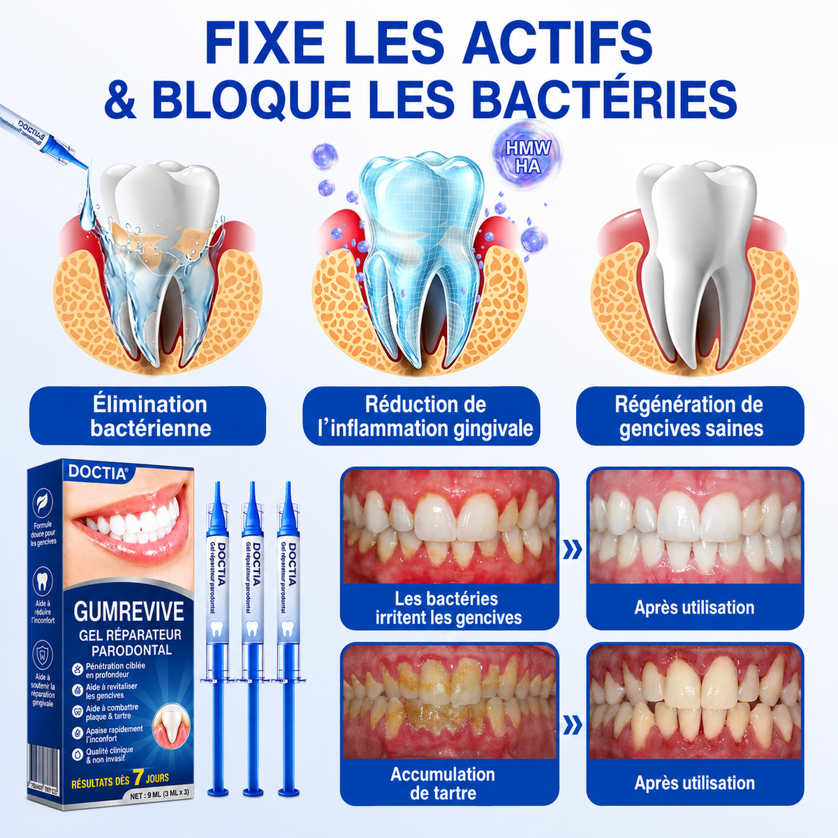🏅🦷🛡️DOCTIA® GumRevive – Gel Réparateur Parodontal pour Gencives Sensibles🍃🍃