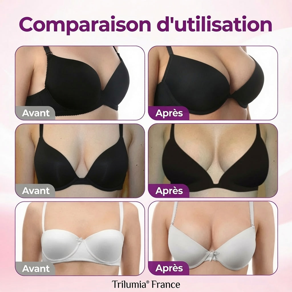 Trilumia®✨PATCH DE MICRONAIGLES NANO AVANCÉ POUR LE VOLUME ET LA FERMETÉ DU SEIN🎀